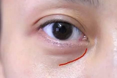 沈陽(yáng)哪家醫(yī)院做雙眼皮好？推薦這幾家，讓你的雙眼美麗動(dòng)人起來(lái)！