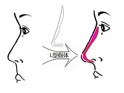 深圳最佳激光脫毛整形醫(yī)院推薦-公立醫(yī)院領(lǐng)跑市場(chǎng)！