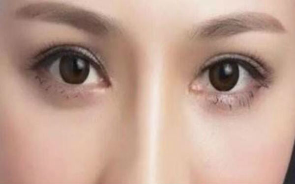 邯鄲割雙眼皮醫(yī)院排行榜TOP5——萊媚儷與德枝美，你需要看看