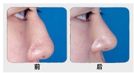 石家莊主要公立整形醫(yī)院排行榜！公辦醫(yī)療機(jī)構(gòu)最具實(shí)力！