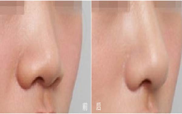 福建五所知名整形醫(yī)院盛世薈萃：瑞麗、愛思特、雅美等品牌強勢入圍！