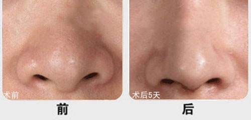 廈門市有哪些醫(yī)院提供優(yōu)質(zhì)的脂肪填充服務(wù)？江頭醫(yī)院、臉康整形醫(yī)院、美麗醫(yī)療中心等值得一看！快來了解一下