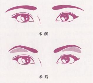 魅力煥發(fā)！常德市多家信譽醫(yī)院助你邁過疤痕困擾