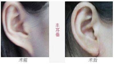2023沈陽去魚尾紋雕塑醫(yī)院排行榜，這十家都備受口碑推崇！