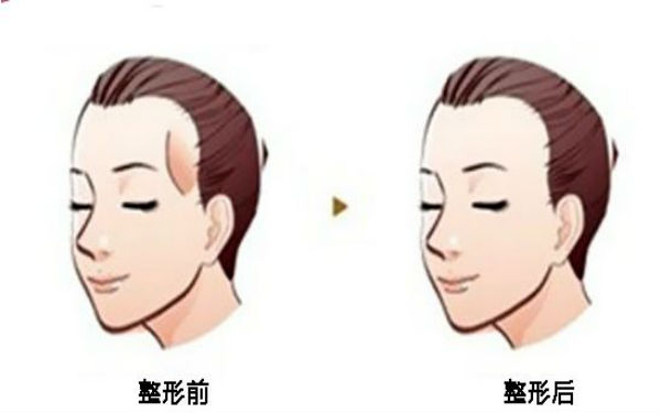 西寧顴骨矯正術(shù)：哪家醫(yī)院口碑好？2023年口碑排名前10的正規(guī)醫(yī)療整形醫(yī)院公布！