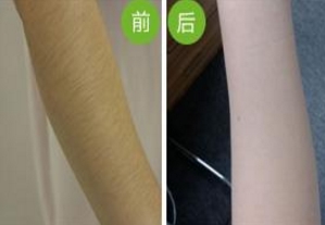 哪家南京雙眼皮手術(shù)醫(yī)院口碑好？2023年南京韓式雙眼皮手術(shù)前十名排序！