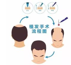 臺州哪里可以去除下眼皮皺紋？2023臺州排名前十的美容醫(yī)院推薦