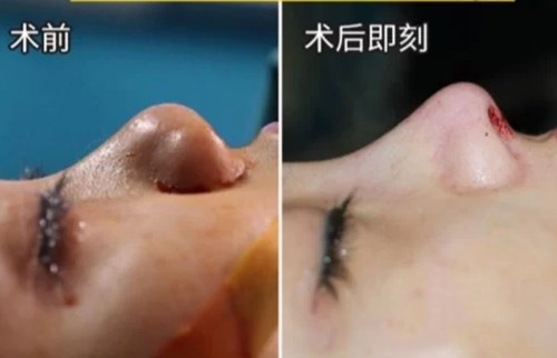 南京最熱門的環(huán)形精雕吸脂醫(yī)療美容醫(yī)院綜合推薦！2023年排行前十名大揭曉！