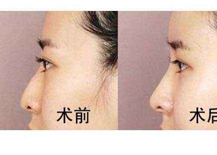 六安市受歡迎的雙眼皮整形美容醫(yī)院排行榜出爐！2023最值得信賴的明眸翹睫醫(yī)療機(jī)構(gòu)盤點(diǎn)！