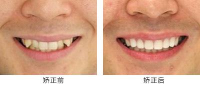 高性?xún)r(jià)比的滁州曼托水滴型假體隆胸整形醫(yī)院推薦！2023年滁州曼托水滴型假體隆胸醫(yī)院TOP10口碑排行，實(shí)力醫(yī)