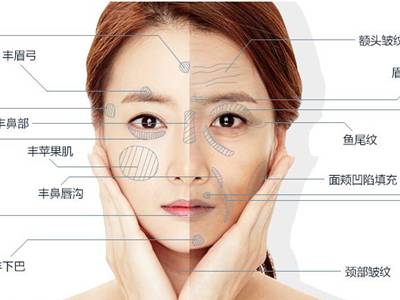 廣州臉部打溶脂針排名前10的美容醫(yī)院口碑大揭秘！2023年很受好評的整形醫(yī)院技術盤點！