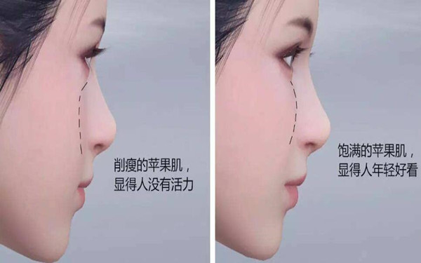 2023年青島小耳畸形矯正醫(yī)院排名榜單-前十大醫(yī)院曝光 2023年青島小耳畸形矯正醫(yī)院排名榜單-前十大醫(yī)院曝光