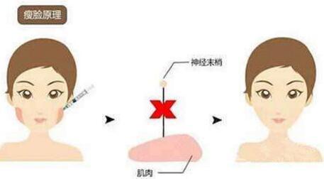 2023武漢隆胸材料取出醫(yī)院排行榜發(fā)布！武漢哪家整形醫(yī)院的推薦度高？