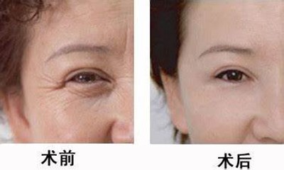 2023年惠州治療木偶紋的十家整形醫(yī)院推薦 2023年惠州治療木偶紋的十家整形醫(yī)院推薦