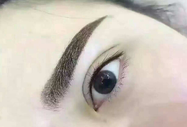 鄭州眉間紋淡化，2023年十大整形美容醫(yī)院推薦