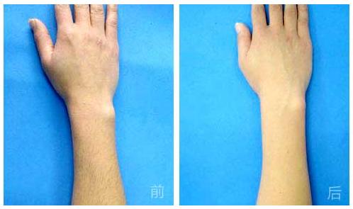 杭州哪家整形美容醫(yī)院能有效避免眼部皺紋？2023年杭州眼部皺紋美容醫(yī)院前十位排行榜來啦！