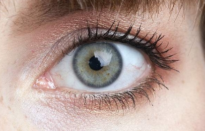 深圳哪個(gè)醫(yī)院的顴骨降低整形效果？2023年度排名前十大整形醫(yī)院點(diǎn)評！