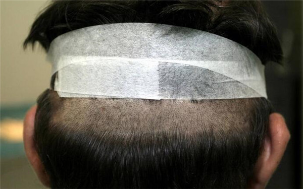 重慶哪家醫(yī)院豐唇口碑好？2023年榜單前十大整形美容醫(yī)院推薦！