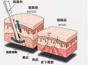 2023蕪湖鼻梁骨矯正醫(yī)院久負(fù)盛名，口碑贊譽(yù)不絕于耳！