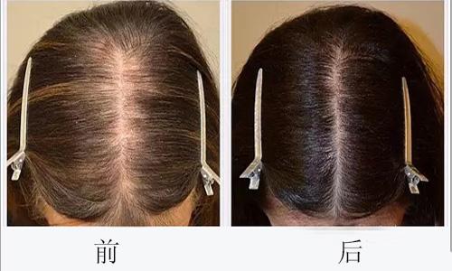 廣州哪些醫(yī)院可靠，專業(yè)進行臉部疤痕切除整形美容？2023年十大排名公開！