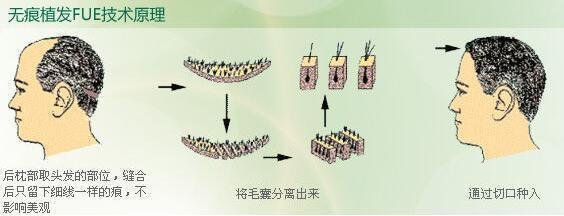 2023青島眼袋修復手術(shù)排名前10的信譽醫(yī)院！