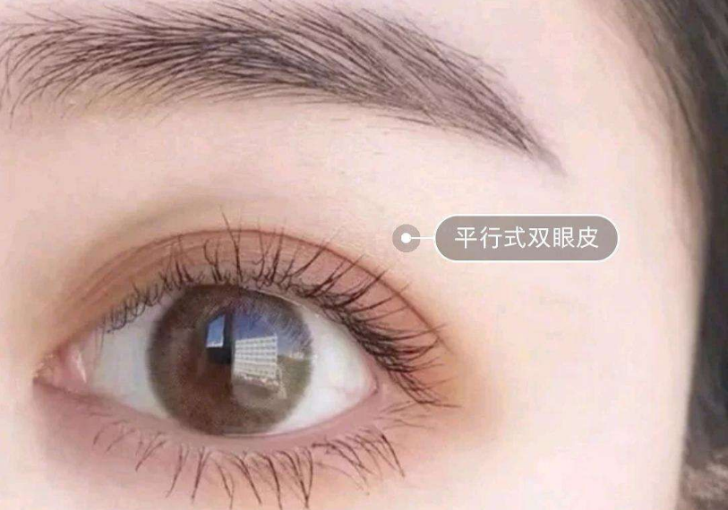 鄭州最受推崇的雙眼皮整形專(zhuān)家推薦榜單露臉！多位實(shí)力經(jīng)驗(yàn)高手霸占榜首！