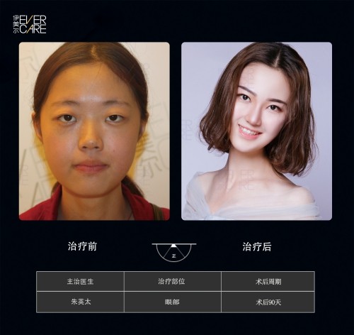 阿爾法9°美眼，打開視界，美無止境