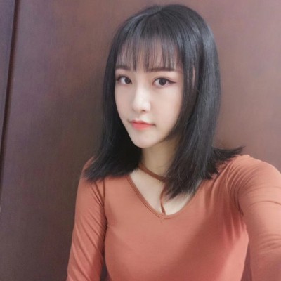 眼綜合術(shù)前VS術(shù)后，自然大眼睛值得稱贊！