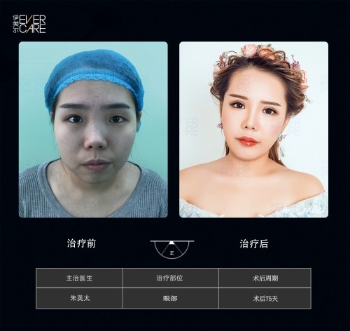 阿爾法9°美眼，打開視界，美無止境
