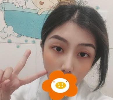 救命，周杰群做的耳軟骨隆鼻恢復(fù)后鼻背線條也太好看了吧