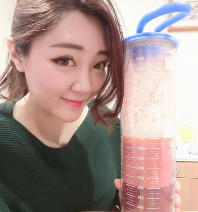 揭陽美萊整形手臂吸脂案例分享，輕松告別拜拜肉