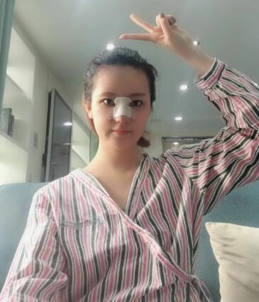 北京葉子整形肋軟骨隆鼻案例反饋，這鼻子是真實(shí)存在的嗎