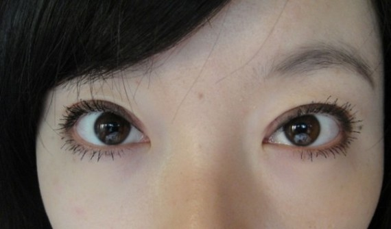 在鄭州望京做全切雙眼皮+開外眼角，術(shù)后效果確實沒讓我失望