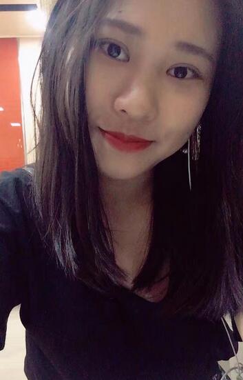 肇慶華美整形切開雙眼皮術(shù)后三個月