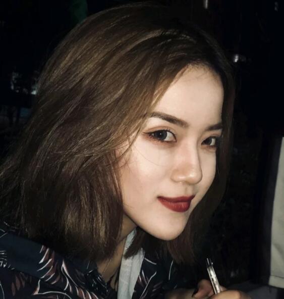 重慶華美下頜角整形術后兩個月效果