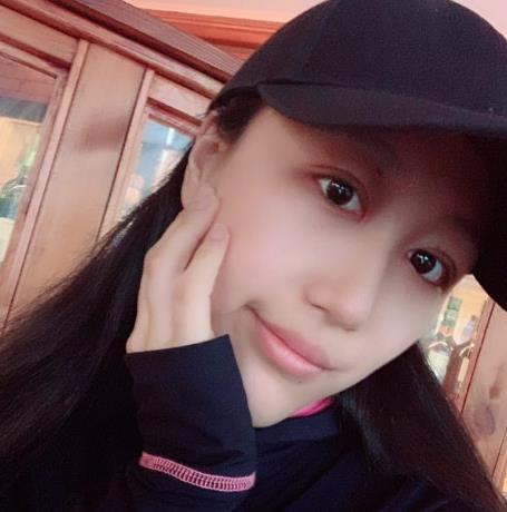 上海華美楊亞益做眼部修復案例效果對比圖