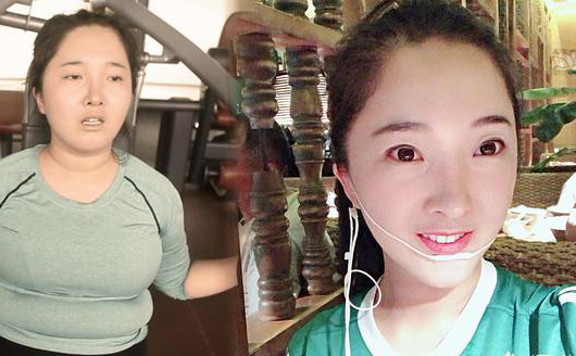埋線減肥是什么？中醫(yī)診所里推出的埋線減肥真有用嗎，有科學依據嗎？