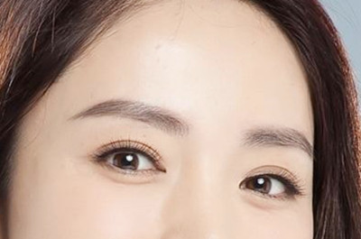 臨沂微整美容醫(yī)院開(kāi)眼角手術(shù)