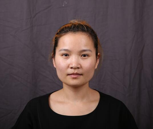廈門華美名媛整形醫(yī)生賈虹下頜角削骨案例效果對(duì)比圖！