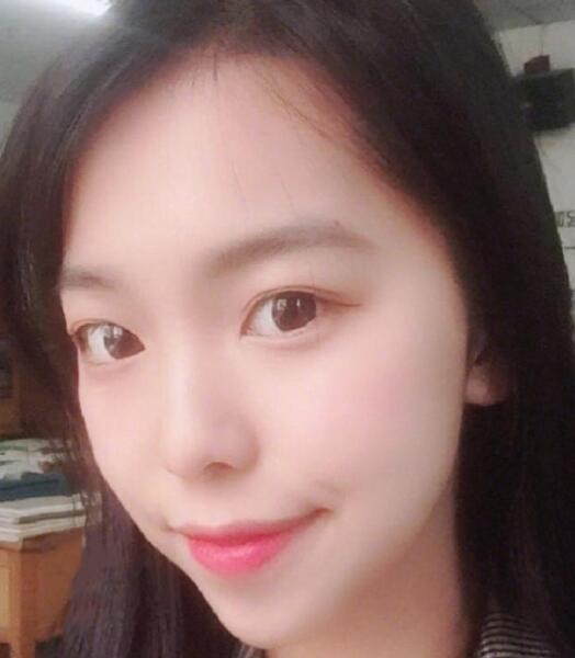 下頜角截骨手術后