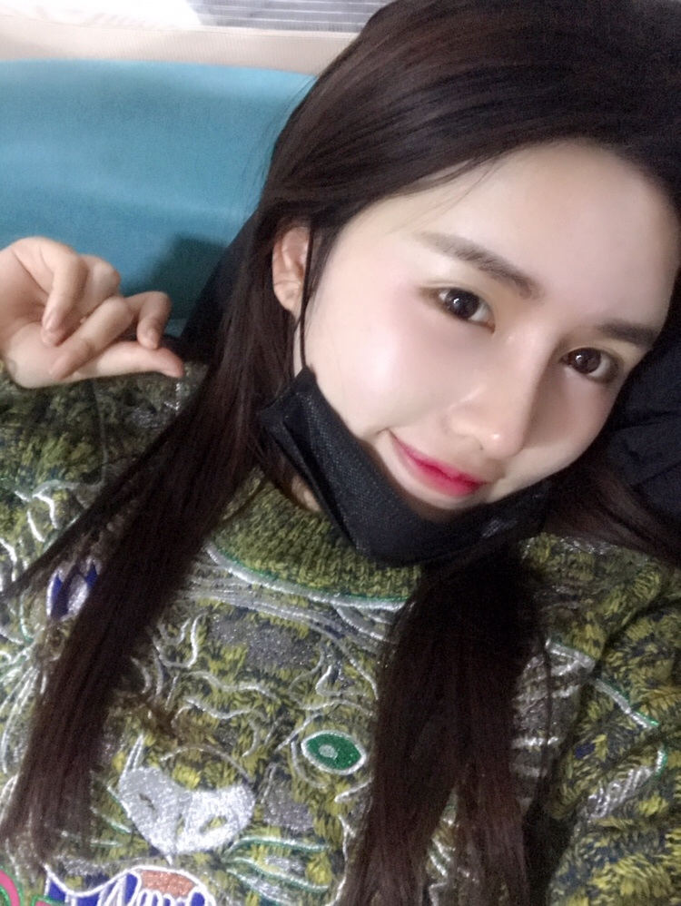 北京星美李寧輝進(jìn)口膨體隆鼻案例效果對(duì)比圖，鼻子自然又美麗