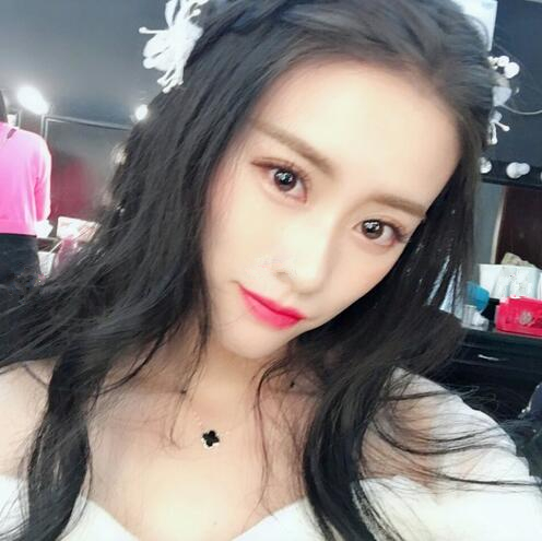 長春銘妍醫(yī)療美容門診部做雙眼皮怎么樣？長春銘妍雙眼皮案例分享