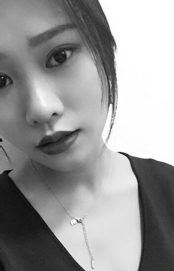 上海伊美爾港華整形醫(yī)生師麗麗做雙眼皮怎么樣？師麗麗雙眼皮案例分享