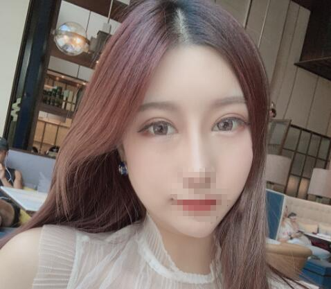 北京彤美整形醫(yī)院專家李長(zhǎng)賦做鼻部綜合整形怎么樣？