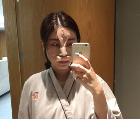 北京彤美整形醫(yī)院專家李長(zhǎng)賦做鼻部綜合整形怎么樣？