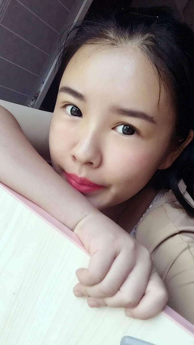 西安莎曼妃醫(yī)療美容醫(yī)院醫(yī)生樸俊做自體脂肪豐太陽穴效果怎么樣？
