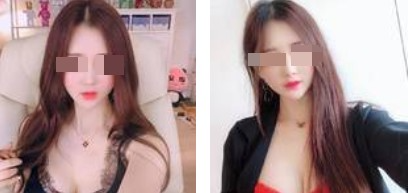 沈陽杏林整形美容醫(yī)院崔昌墉醫(yī)生做假體隆胸技術怎么樣？附案例