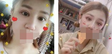 做了全切雙眼皮不僅外表變美了，內(nèi)心也更加自信了