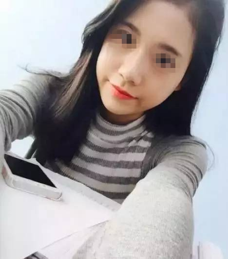 做完膨體隆鼻，鼻子變“挺”了