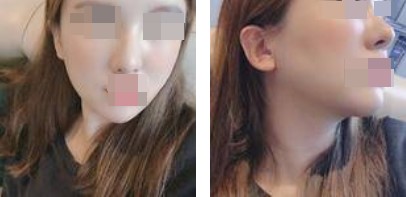 恢復(fù)過(guò)程